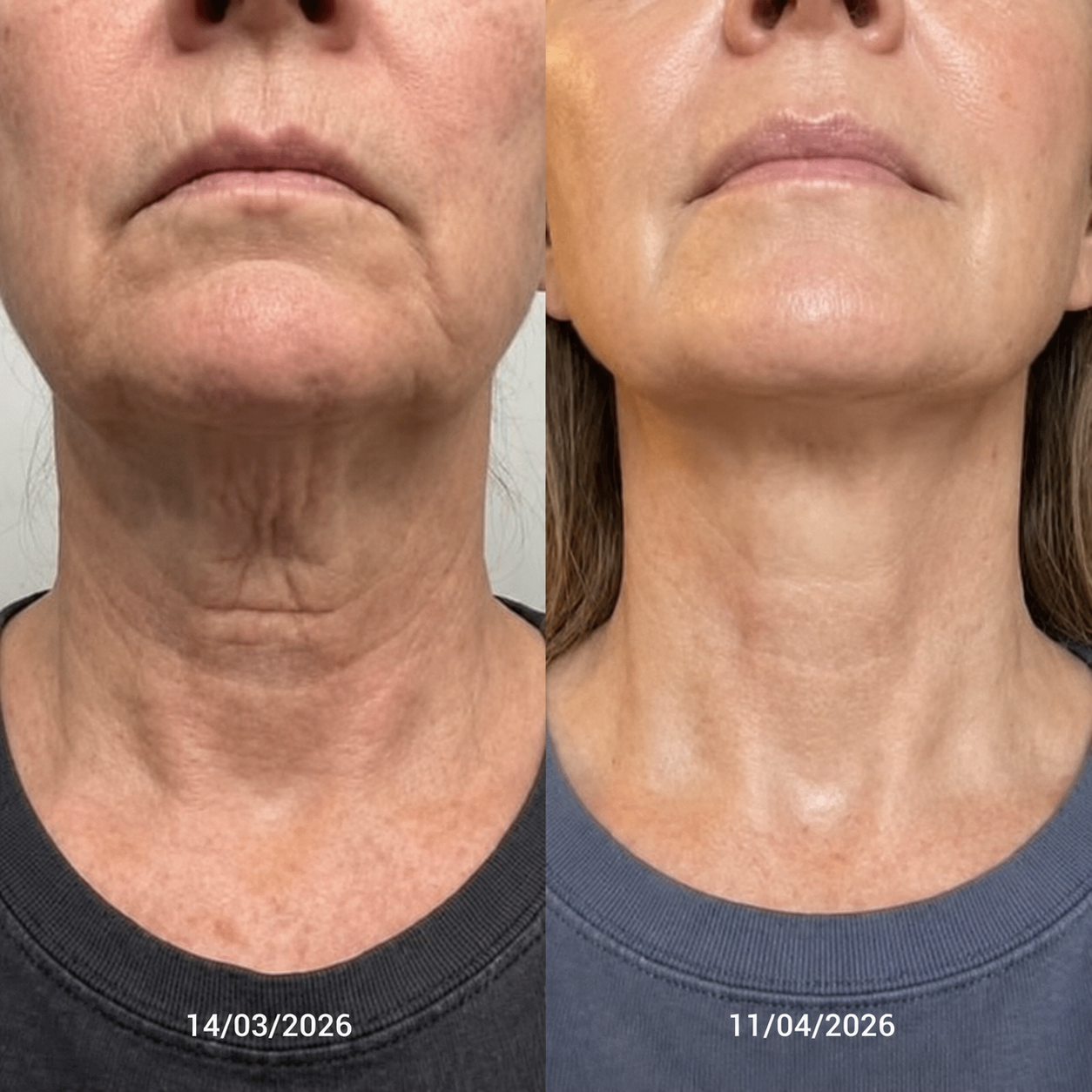 Crema para el cuello Reafirma & Alisa Nuvessia®